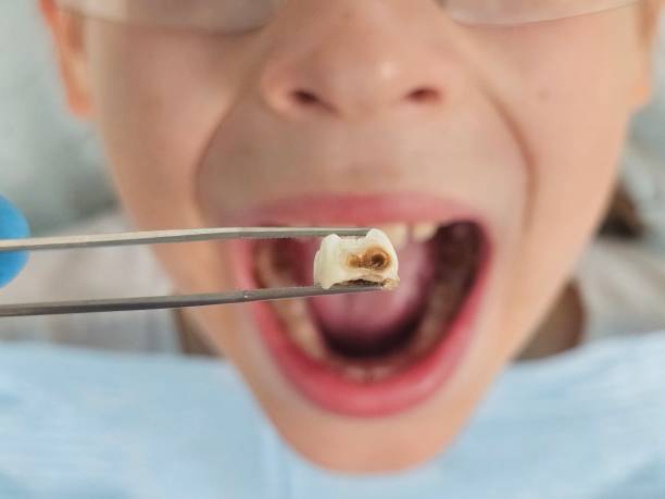 Best Emergency Pediatric Dental Care in Warrington, FL